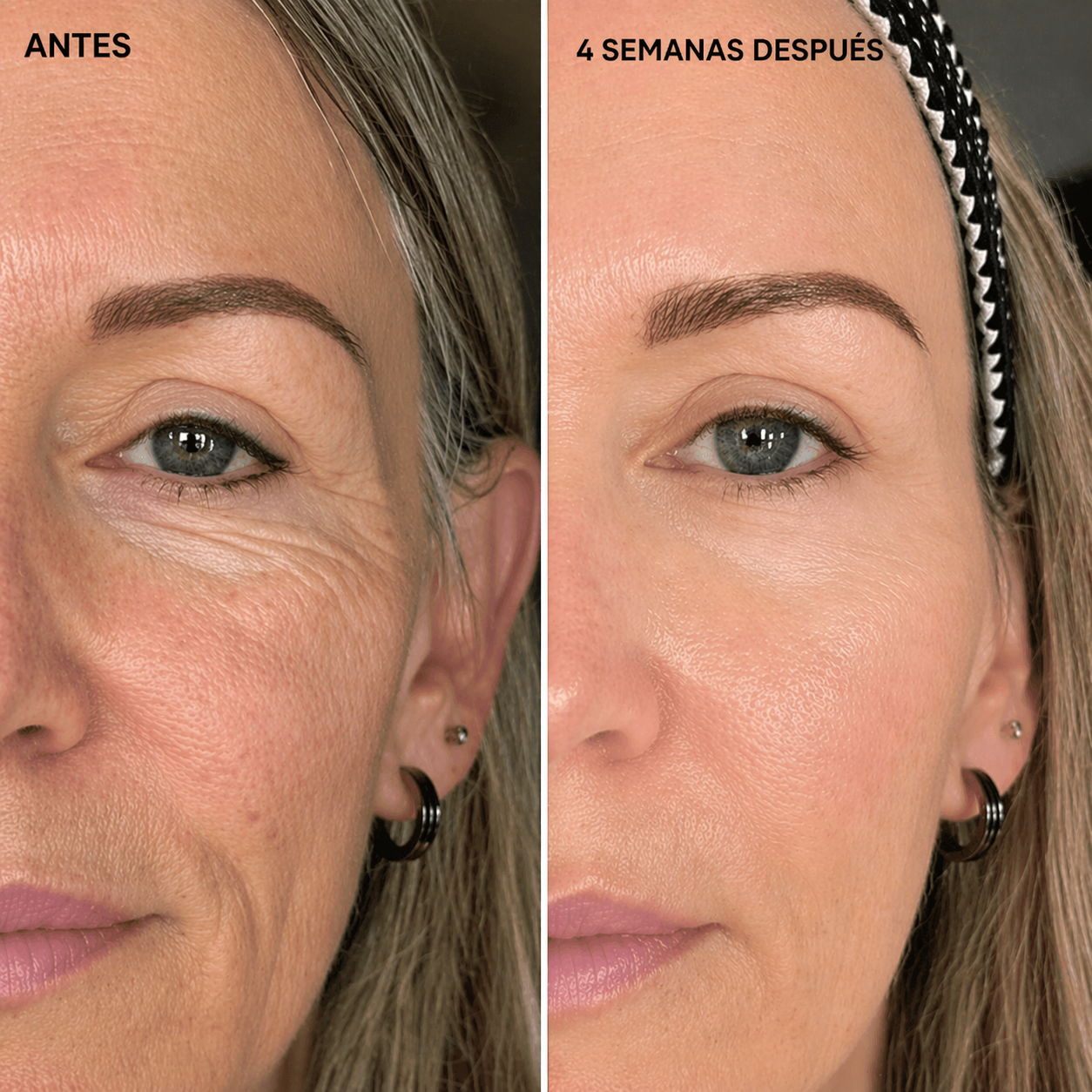 Deep Collagen - Serum para lifting facial en casa con péptidos y colágeno profundo